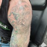 Laser Tattoo Cover Up Services at Fearless Tattoo Removal