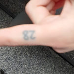 Tattoo Removal on Index Finger of The Number 28