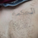 Semi Removed Chest Tattoo